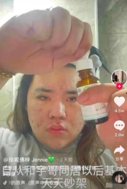 吃瓜事件网红儿子,揭秘事件背后真相